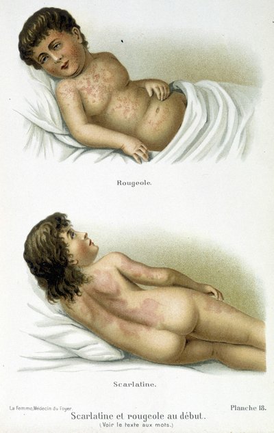 Spála a spalničky – 19. století od Unknown artist