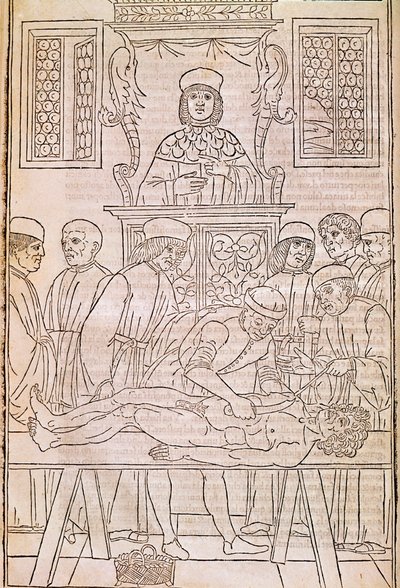 Pitva. Codice. Tělo mrtvého muže pitvají lékaři pro studii anatomie. "" Fasciculus Medicinae ". Kodex lékařského svazku od Johannese Kethana od Unknown artist
