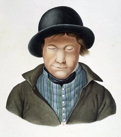 Malomocní z Islandu, cca 1840, B.N. od Unknown artist