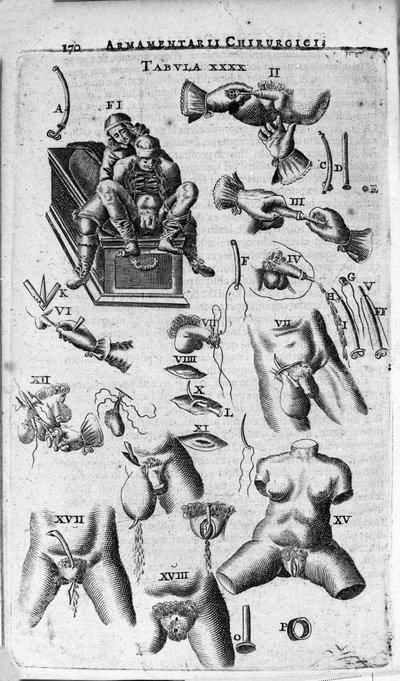 Chirurgické zákroky na ženském a mužském pohlaví. Rytina v „Armamentarium Surgical“ od J. Sculteta, Benátky od Unknown artist