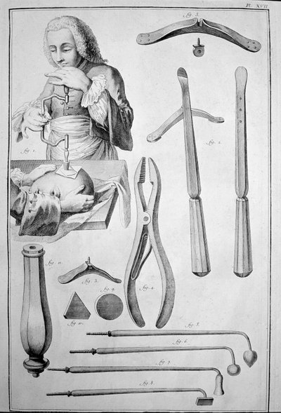 Trepanace lebky, různé nástroje (rytina od Unknown artist