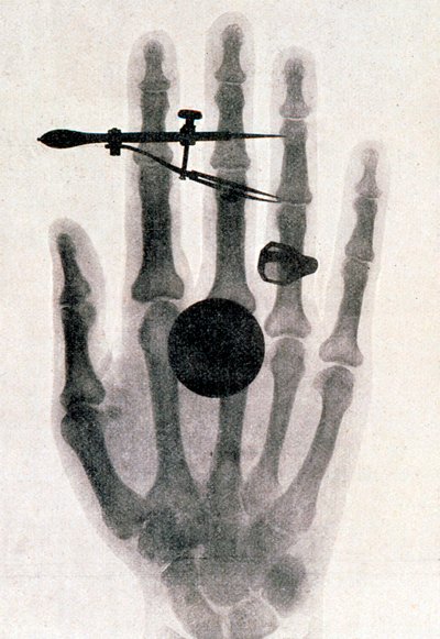 Rentgenová fotografie ruky jeho manželky Wilhelma Roentgena, 1896 od Wilhelm Conrad Rontgen