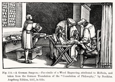 Německý chirurg, z Consolation of Philosophy od Boethia, ilustrace z Vědy a literatury ve středověku a renesanci, napsal a vyryl Paul Lacroix, 1878 (bw ph od after German School