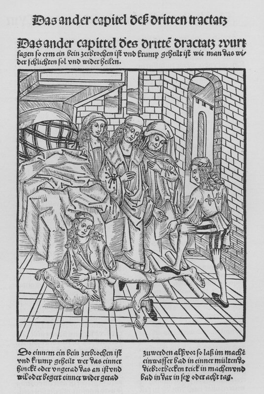 Kniha Cirurgia od Hieronyma Brunschwiga (litho) od (after) German School