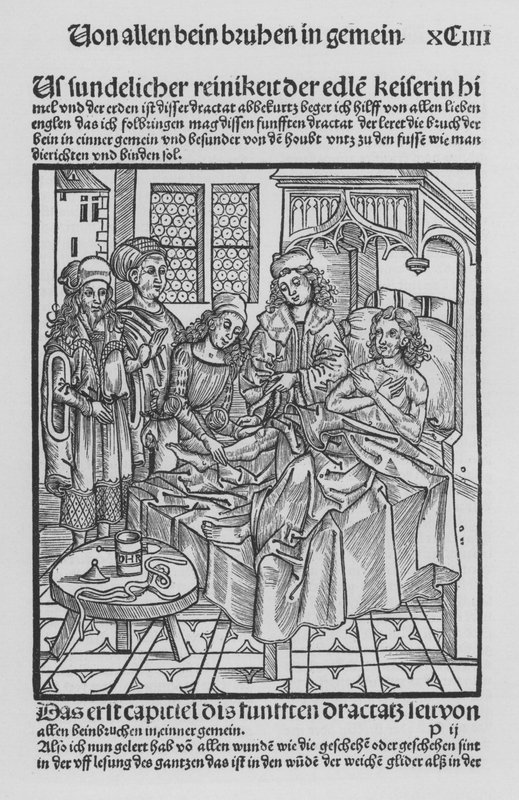 Kniha Cirurgia od Hieronyma Brunschwiga (litho) od (after) German School
