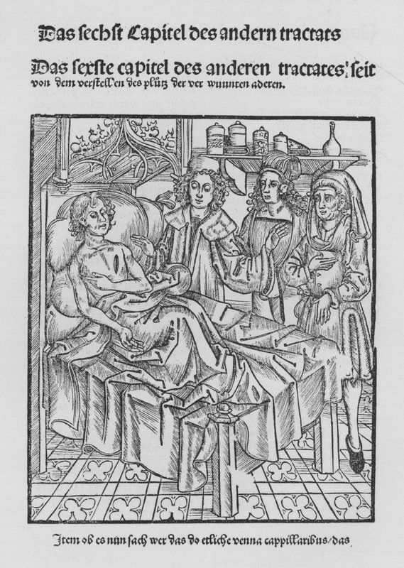 Kniha Cirurgia od Hieronyma Brunschwiga (litho) od (after) German School