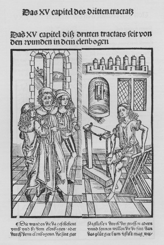 Kniha Cirurgia od Hieronyma Brunschwiga (litho) od (after) German School