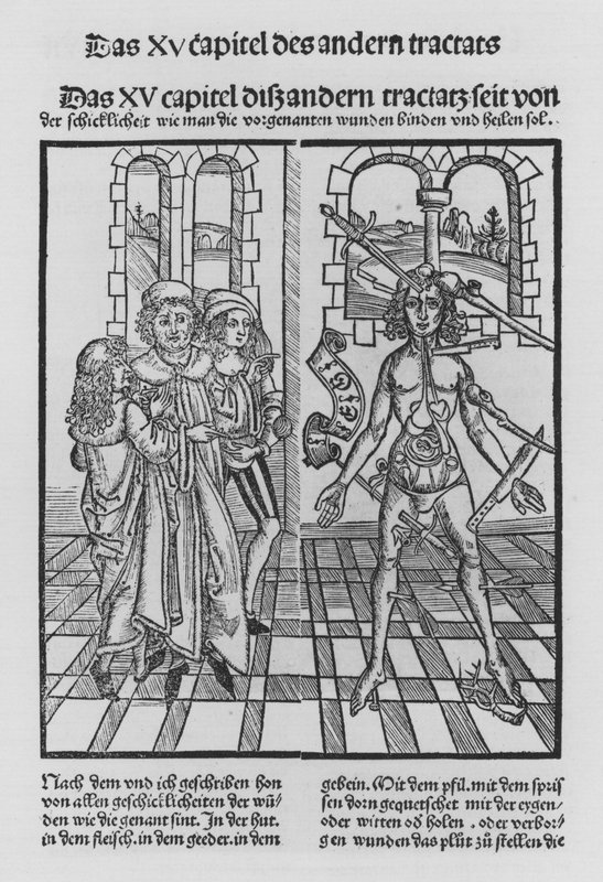 Kniha Cirurgia od Hieronyma Brunschwiga (litho) od (after) German School