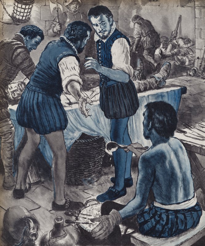 Ambroise Pare, vojenský chirurg, když došel olej (litho) od English School