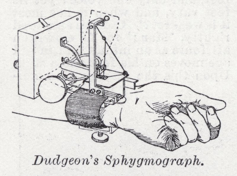 Dudgeonův sfygmograf (litho) od English School