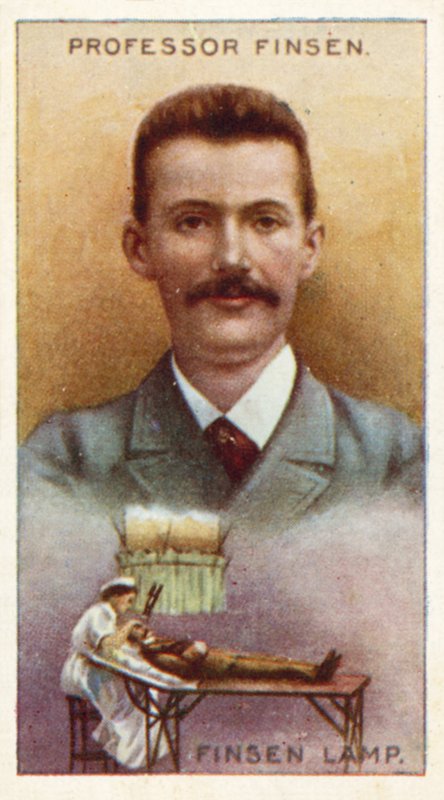 Profesor Finsen, Finsen Lamp od English School