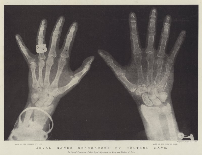 Royal Hands reprodukované Rontgen Rays (rytina) od English School