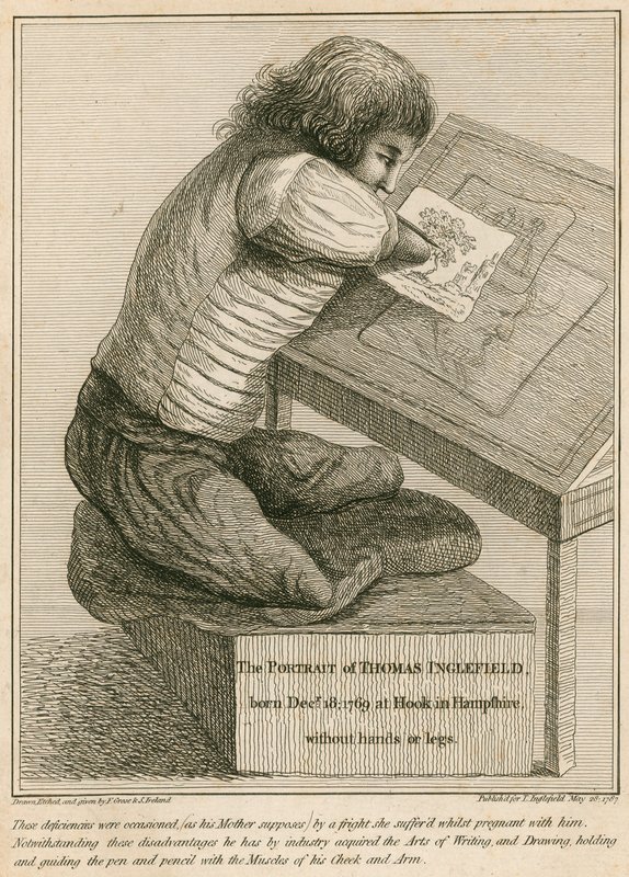 Thomas Inglefield, narozen 18. prosince 1769 v Hook, Hampshire, bez rukou a nohou od English School