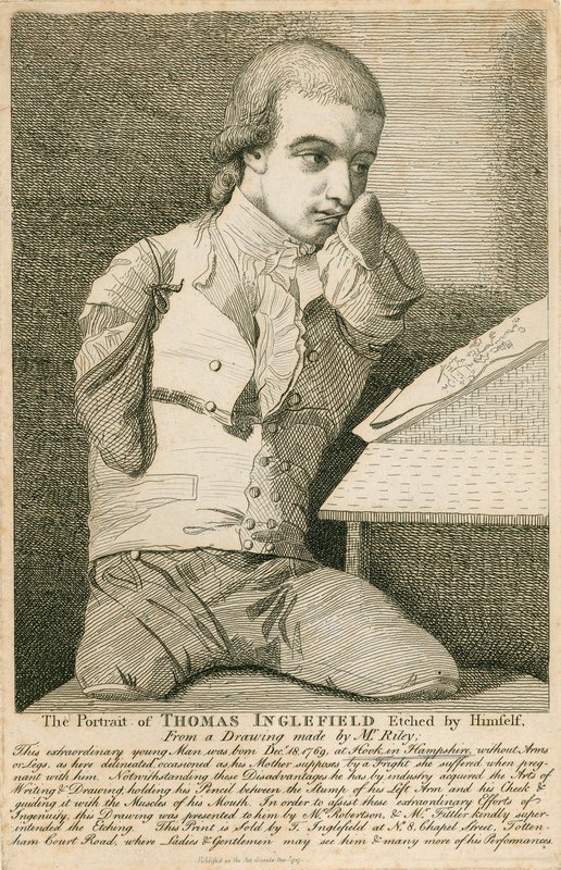Thomas Inglefield, narozen 18. prosince 1769 v Hook, Hampshire, bez rukou a nohou od English School
