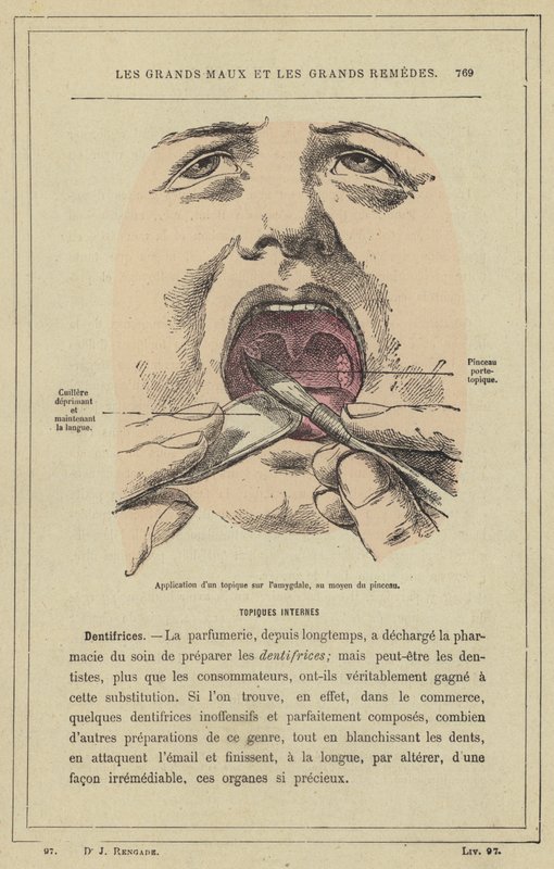 Aplikace topika na mandlu pomocí štětce (barva litho) od French School