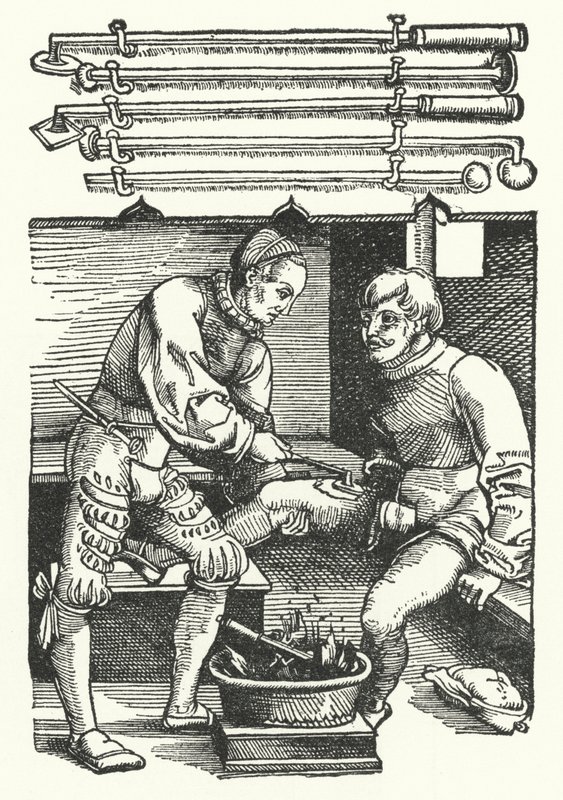 Chirurg kauterizující ránu na noze vojáka (rytina) od German School
