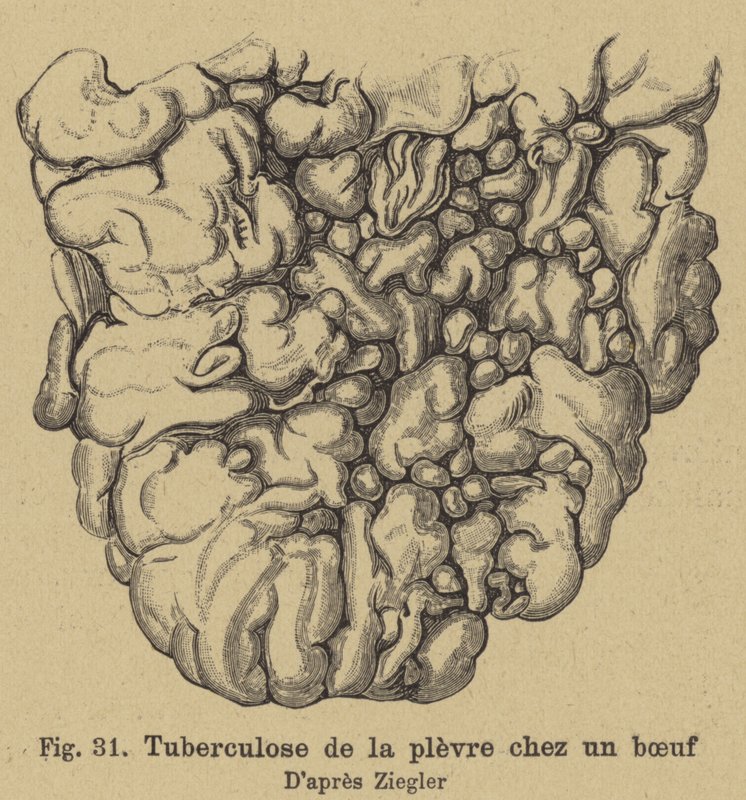 Tuberkulóza skotu od German School