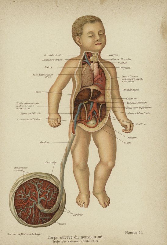Výřezový diagram zobrazující vnitřní orgány novorozence a jeho pupeční šňůru (barva litho) od German School