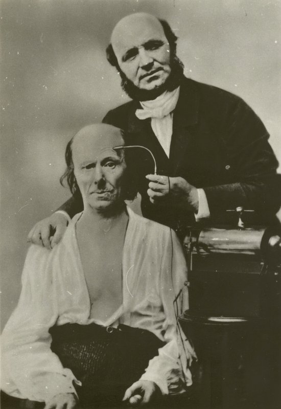 Francouzský neurolog Duchenne de Boulogne pomocí svého elektrofyziologického přístroje na starém muži od Guillaume Benjamin Armand Duchenne de Boulogne
