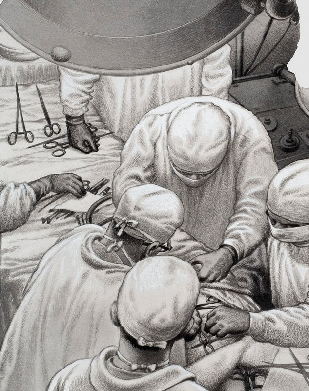 Srdeční chirurgie, jejímž průkopníkem byl profesor Christiaan Barnard (kvaš na papíře) od Pat (1907 95) Nicolle