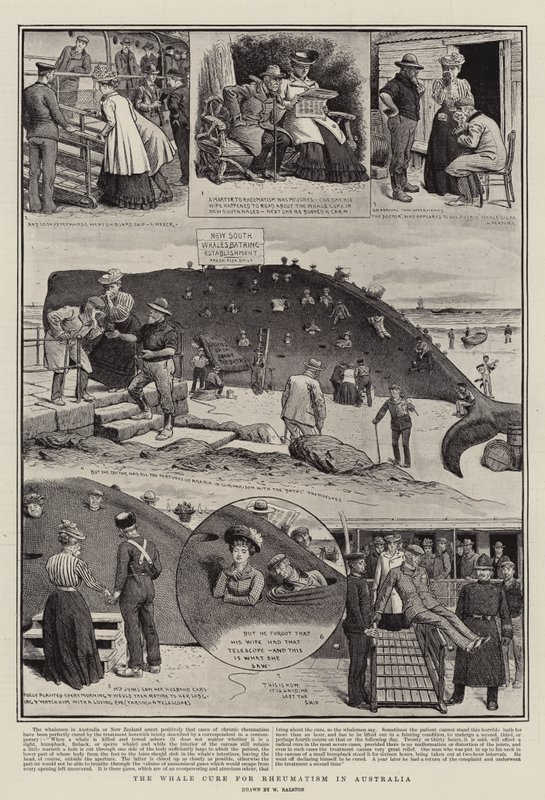 Velrybí lék na revmatismus v Austrálii od William Ralston