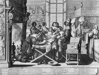 Série rytin (vodní forte) s názvem „“The Marriage to the City“““ z roku 1633 od Abrahama Bosse – „“Porod“““: na pracovním lůžku.