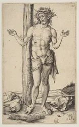 Muž bolesti s nataženýma rukama, ca. 1500.