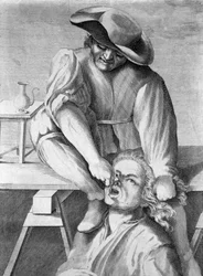Vytahovač zubů (rytina, 18. století)