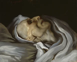 Théodore Géricault na smrtelné posteli