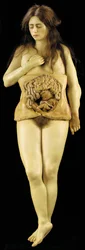 Anatomický model ovariálního těhotenství