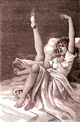 Hysterie, extrémně duševní jev, psychózy a psychoneuróza. 1887 (rytina)