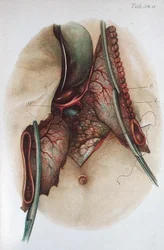 Talíř z „Atlasu a ztělesnění operativní chirurgie“ od Dr. Otto Zuckerkandla (1861-1921) 1910 (barevná rytina)
