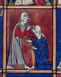 Sloane 1977 f.2 Operace na lebce pacienta, ilustrace z 