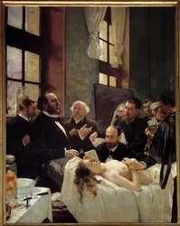 Dr. Jules-Émile Péan (1830-1898) vyučuje v nemocnici Saint-Louis svůj objev svorkování cév. „Před operací“. Obraz Henriho Gervexe (1852-1929), 1887. V. 2,42 x 1,88 m, Paříž, Musée d