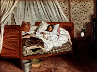 Improvizovaná sanitka (Claude Monet zraněn). Obraz Jeana Frédérica Bazilla (1841-1870)