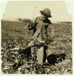 Alex Reiber ve věku 7 let přelévá cukrovou řepu poté, co si „zahákl“ koleno, poblíž Sterling, Colorado, 1915