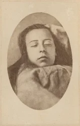 Záchvat hysterie, druhá fáze, ilustrace z "Iconographie Photographique de La Salpetriere" od Bourneville et P. Regnard, deska III, Paříž, 1876 (albumenový tisk)