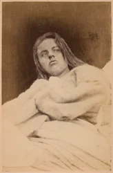 Hysterická epilepsie, halucinace, pohrdání, tabule XXXI z „Fotografické ikonografie Salpêtrière“ od Bournevilla a P. Regnarda, Paříž, 1876