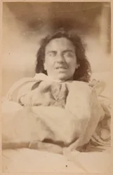 Hysterická epilepsie, halucinace, ironie, tabule XXXII z „Iconographie Photographique de La Salpêtrière“ od Bournevilla a P. Regnarda, Paříž, 1876