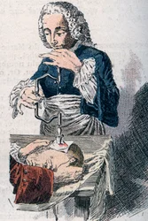 Trepanace. Tisk z 18. století.