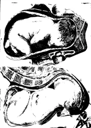 Fleuron z knihy: Pojednání o teorii a praxi porodní asistence.